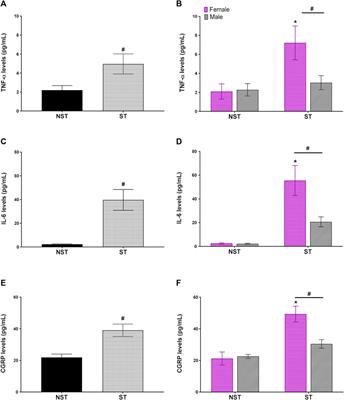 Unpredictable Sound Stress Model Causes Migraine-Like Behaviors in Mice With Sexual Dimorphism